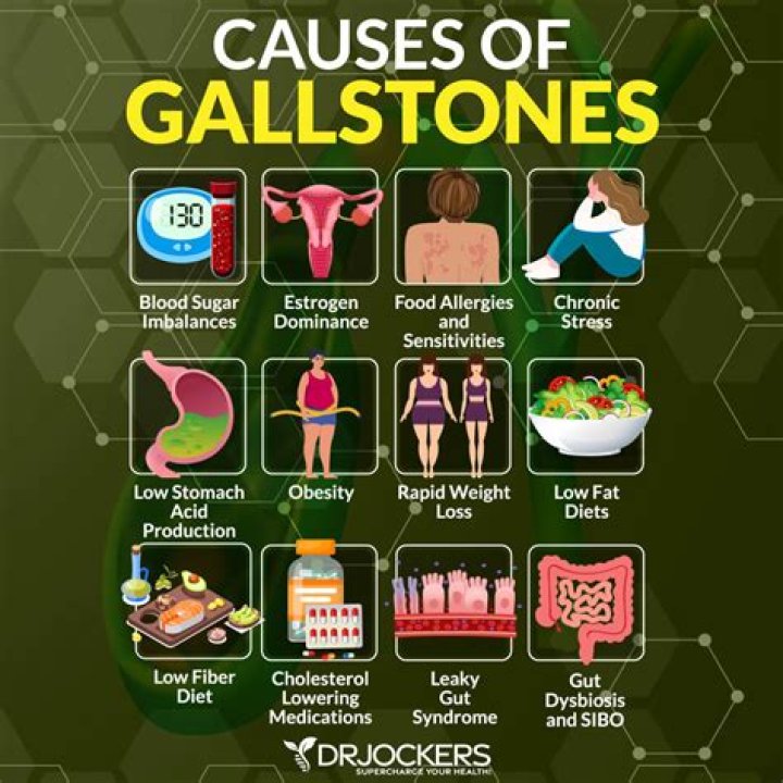 Can gallstones cause stroke?