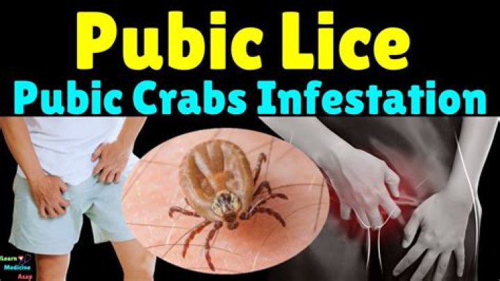 Can you get pubic lice from toilet seats?