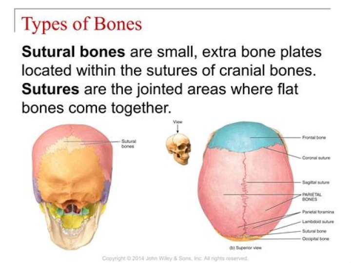 Does everyone have Sutural bones?