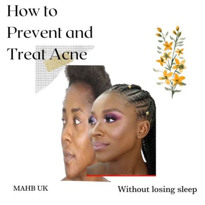 Does sleep help with acne?