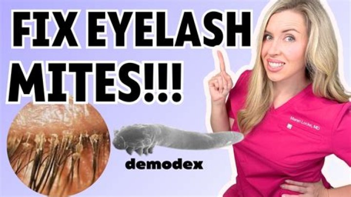 How do you get rid of Demodex mites on your scalp?