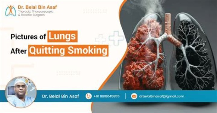 Is it better to cut down on smoking before quitting?