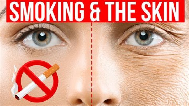 When will my skin look better after quitting smoking?